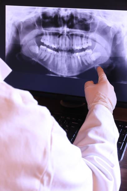 Best Knocked-Out Tooth (Avulsed Tooth) Treatment in Eden, TX